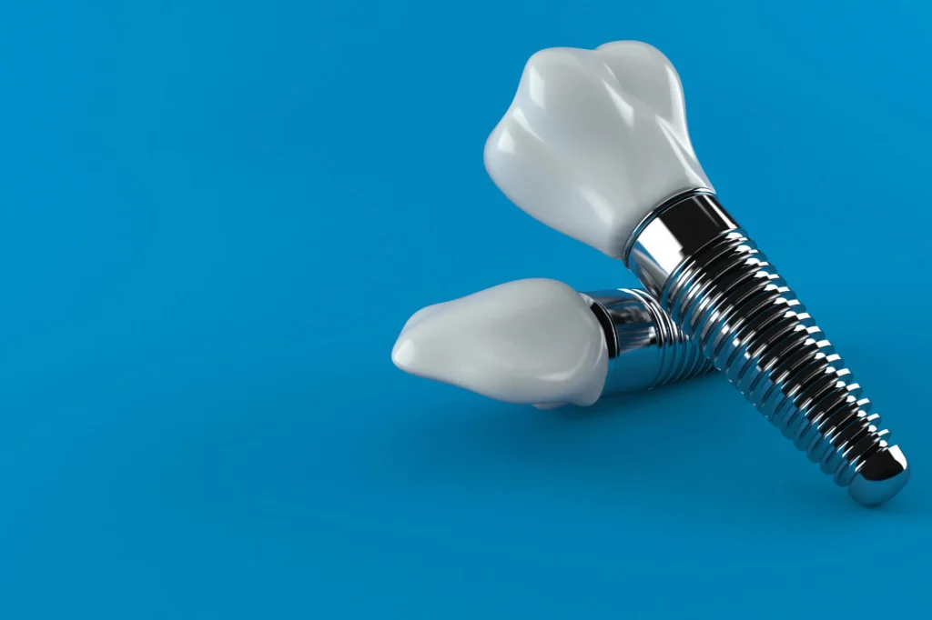 dental implants moody al