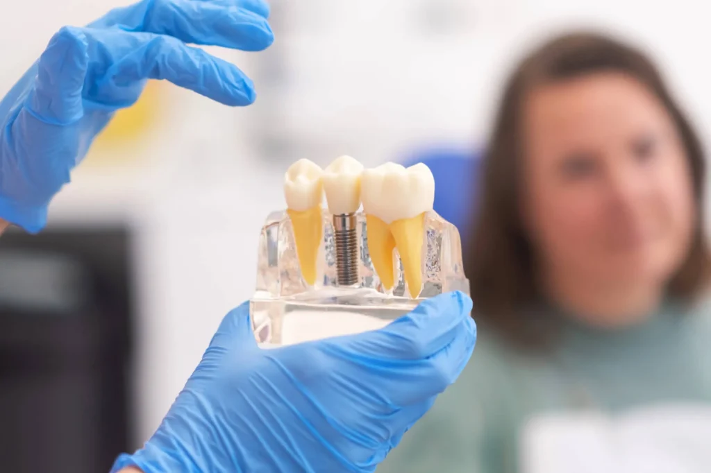 dentist showing patient a model of dental implants moody al