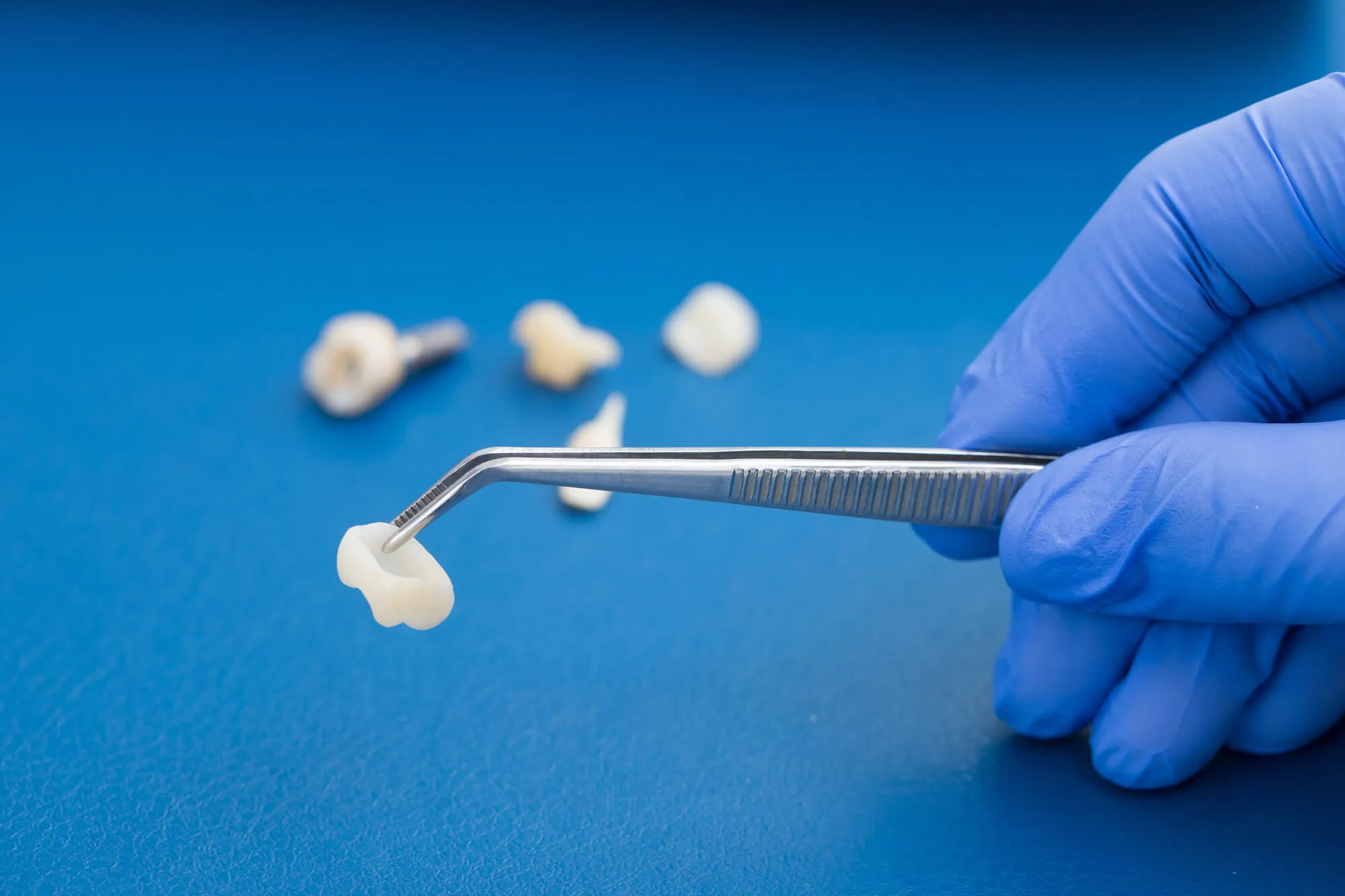 dentist in st. clair county showing patient a sample of a crown