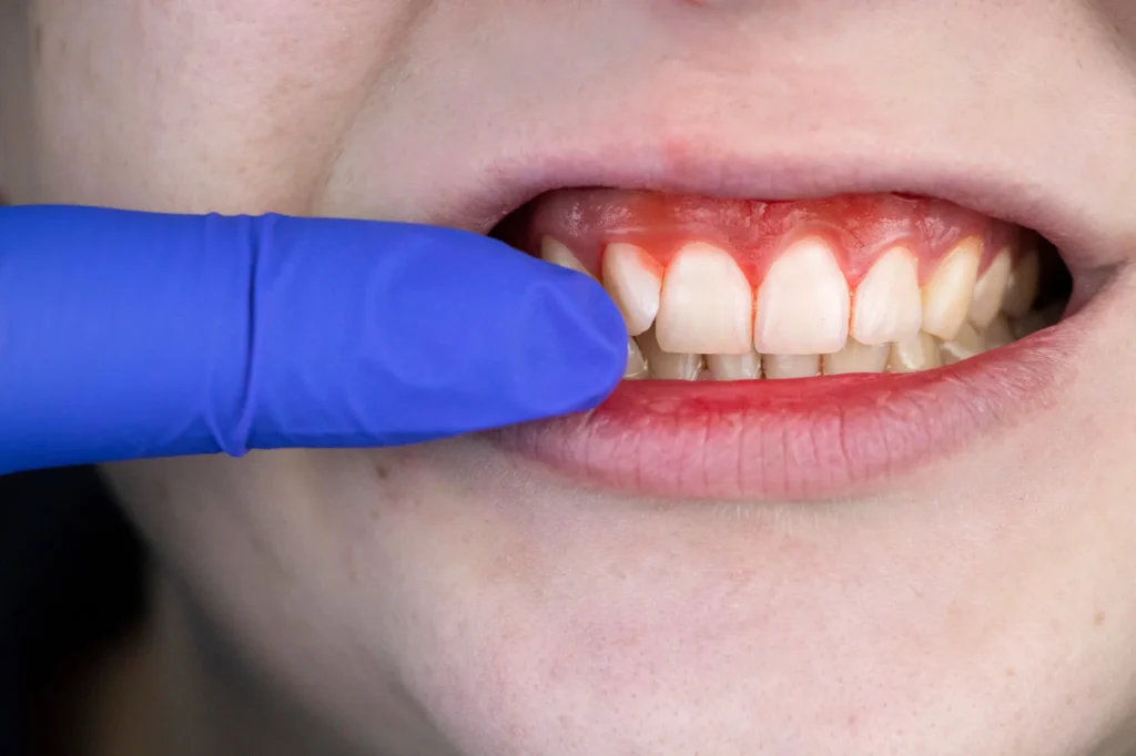 appointment-at-dental-clinic-moody-al