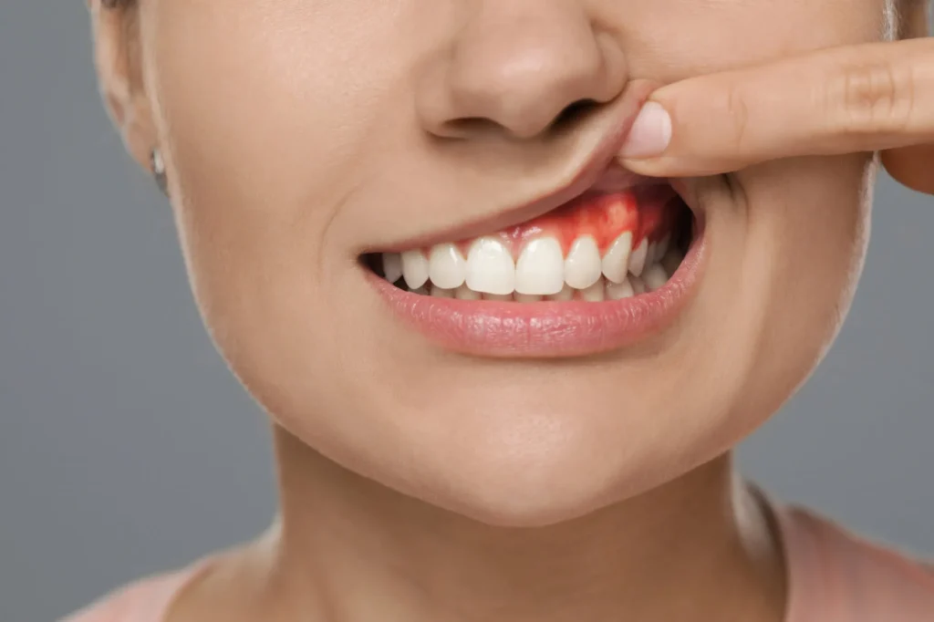 woman-with-gum-disease-needs-an-appointment-in-a-dental-clinic-moody-al